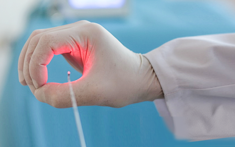 Подготовка к геморроидэктомии — рекомендации пациенту перед операцией 