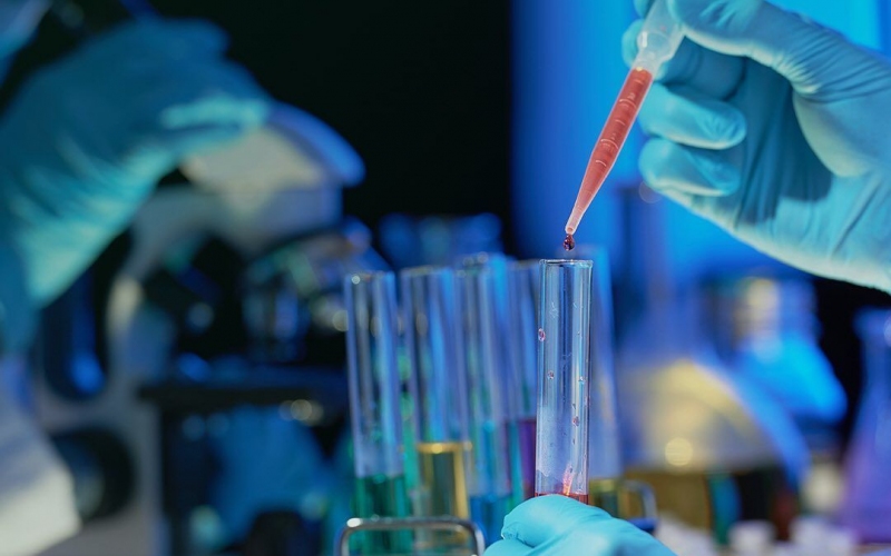 С-реактивный белок и мочекаменная болезнь