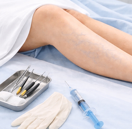  Безоперационные методы лечения