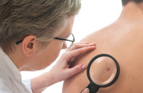 День меланомы в клинике Основа