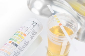 Анализ суточной мочи на 10 показателей